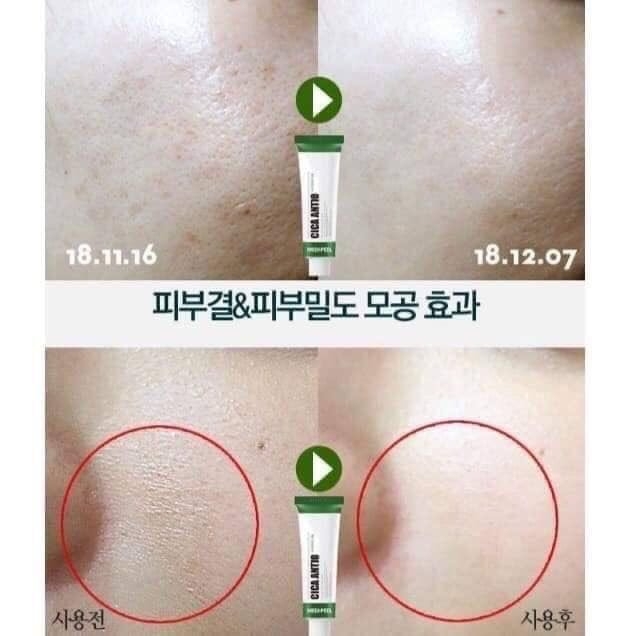 Medi-Peel, Medi-Peel รีวิว, Medi-Peel ราคา, Medi-Peel Cica Antio Cream, Medi-Peel Cica Antio Cream รีวิว, Medi-Peel Cica Antio Cream 30ml, Medi-Peel Cica Antio Cream 30ml ครีมบำรุงผิว, ครีมบำรุงผิว, ครีม